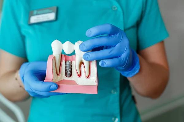 Reliable Dentist Abbotsford Expert Oral Care
