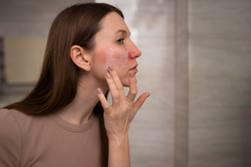 How Shata Dhauta Ghrita Supports Skin Barrier Repair